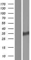 HSD17B11 Protein (Over-Expression Lysate Myc-DDK (Flag))