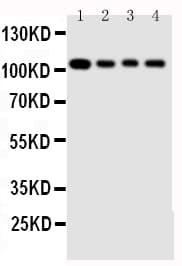 HSPH1 / HSP105 Antibody (aa713-733)