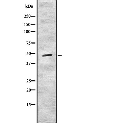 CRLF1 Antibody