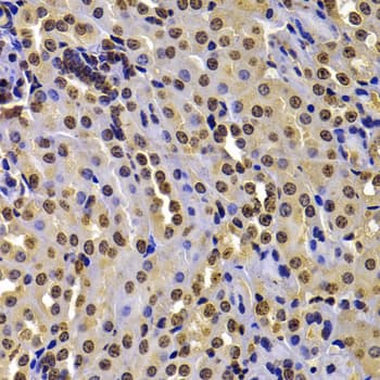 WHSC1 / NSD2 Antibody