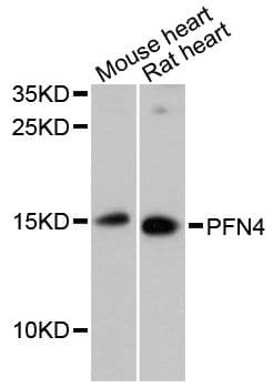 Polyclonal Rabbit anti-Human PFN4 Antibody (WB)