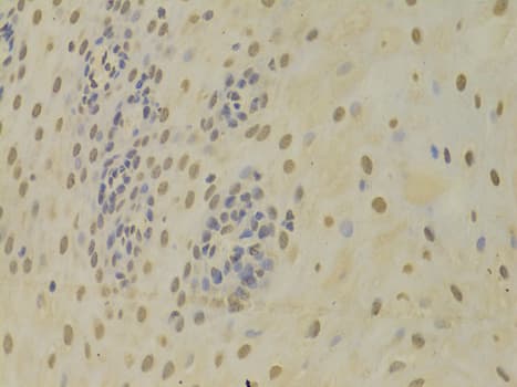 Polyclonal Rabbit anti-Human HNRNPK / hnRNP K Antibody (IHC, IF, WB)