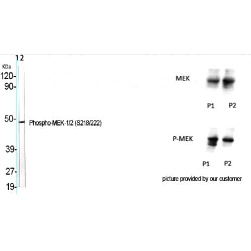 Polyclonal Rabbit anti-Human MEK1 + MEK2 Antibody (160-240 aa, IHC, WB)