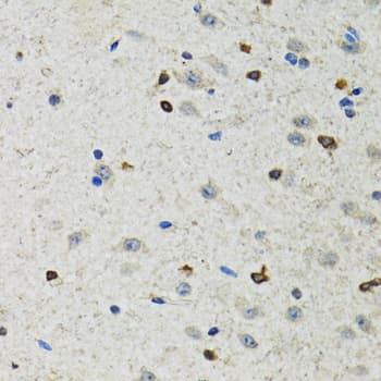 BHLHB2 / DEC1 Antibody