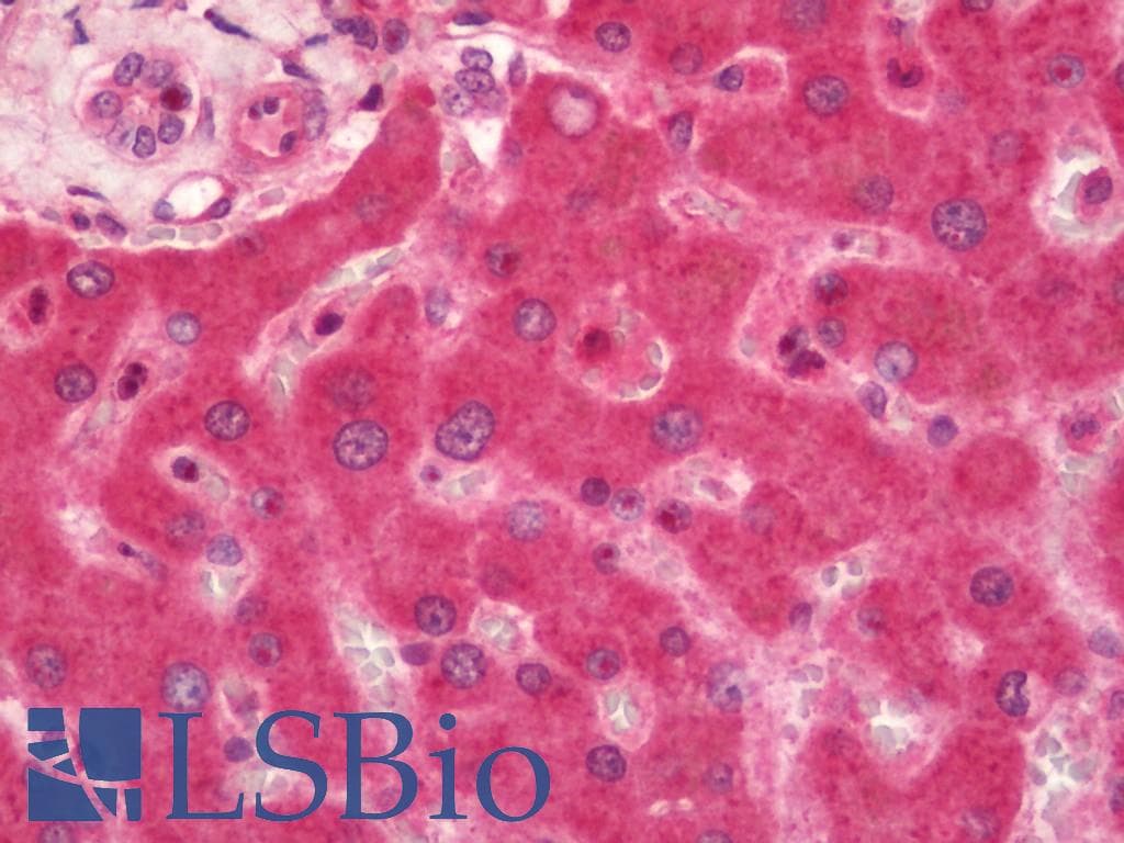 ADRBK1 / GRK2 Antibody (HRP)