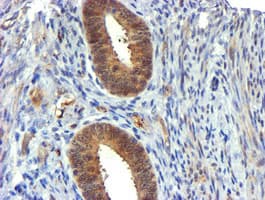 USP7 / HAUSP Antibody (clone OTI1B2)