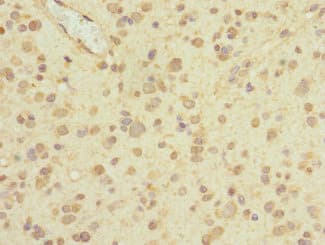 Polyclonal Rabbit anti-Human PIEZO1 / FAM38A Antibody (IHC)
