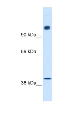 N-CoR / NCOR1 Antibody (aa484-533)