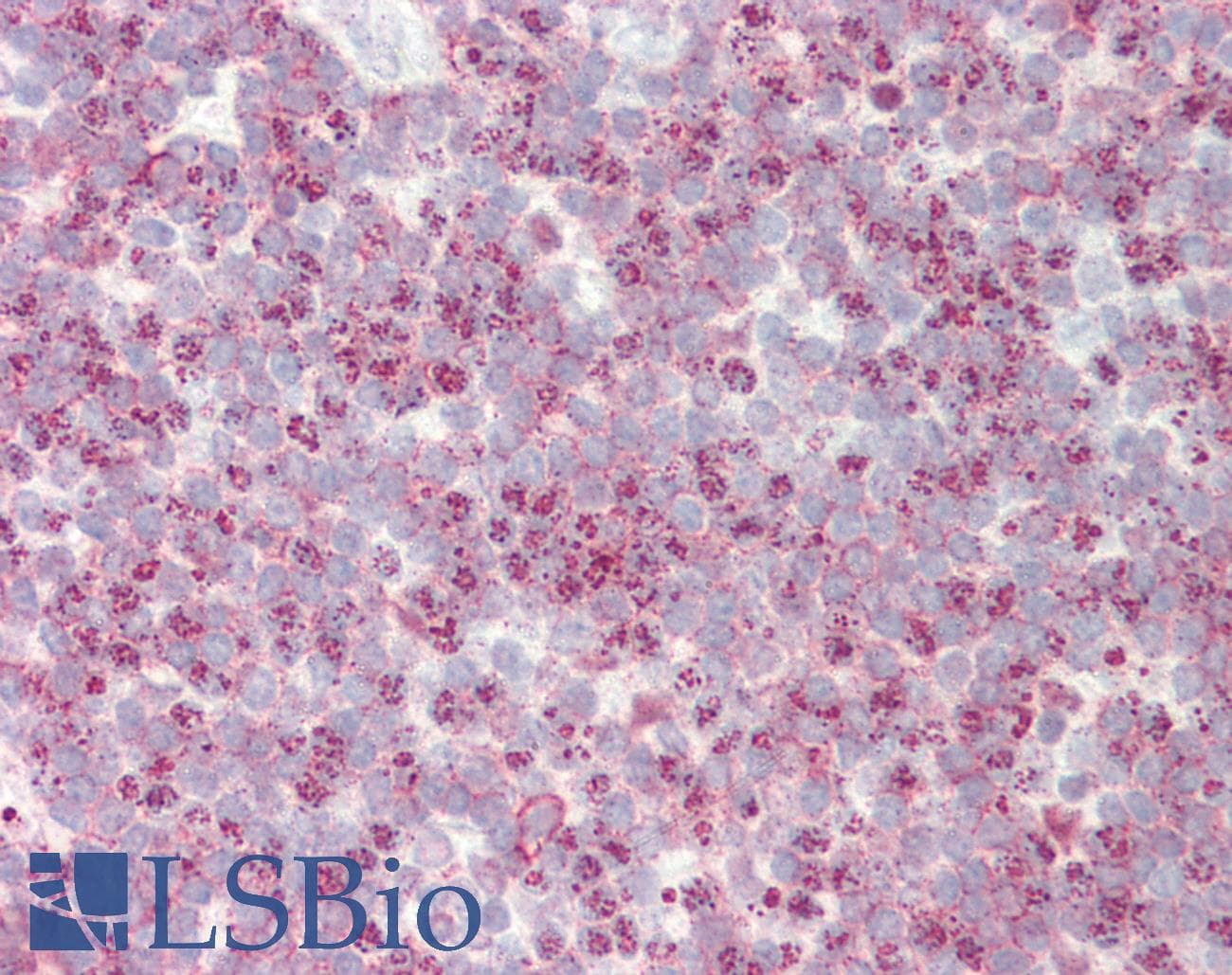 Polyclonal Rabbit anti-Human SLC24A1 / NCKX Antibody (aa612-661, IHC, WB)