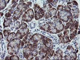 TPD52L3 Antibody (clone OTI8C12)