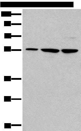 TRIM27 Antibody