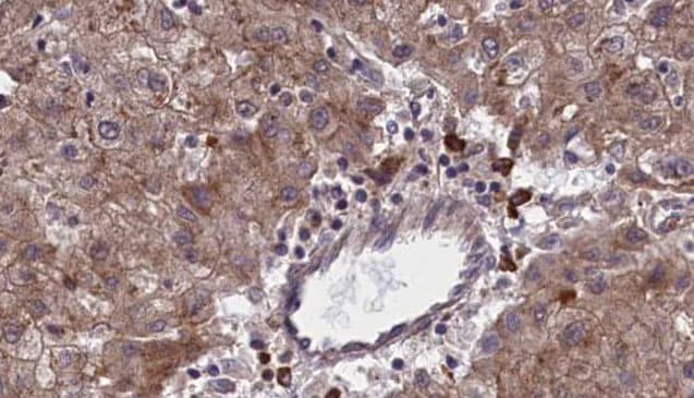 Polyclonal Rabbit anti-Human OR1F1 Antibody (IHC, WB)