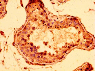 Polyclonal Rabbit anti-Human STAG3 Antibody (IHC)