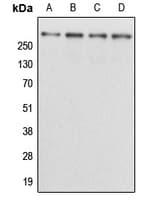 Polyclonal Rabbit anti-Human KALRN / KALIRIN Antibody (Internal, IHC, IF, WB)