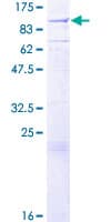 Human EXT1 Protein (Recombinant GST)