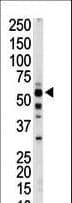PKLR Antibody (aa521-551)