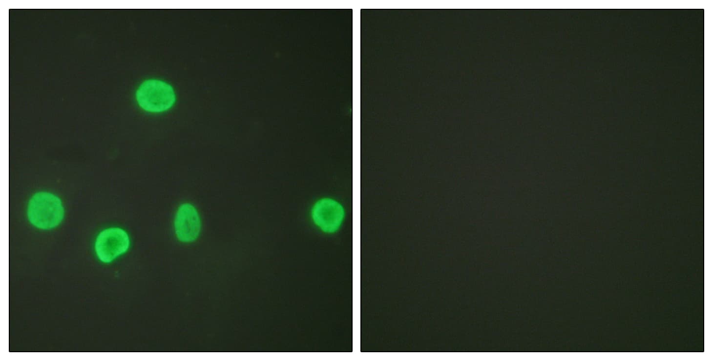IHC-plus™ Histone H3 Antibody (Acetyl-Lys18)