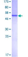 Human UNC119 / Retinal Protein 4 (Recombinant GST)