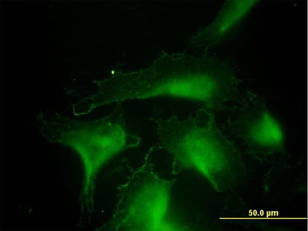 IHC-plus™ Monoclonal Mouse anti-Human DNAJA4 Antibody (clone 4B4-1F2, IHC, IF, WB)