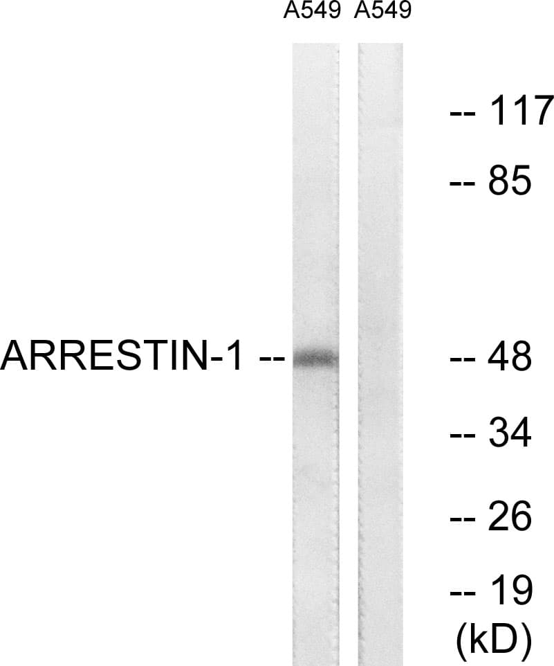 Polyclonal Rabbit anti-Human ARRB1 / Beta Arrestin 1 Antibody (aa369-418, IHC, IF, WB)