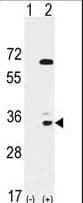 Polyclonal Rabbit anti-Human EPHA10 / EPH Receptor A10 Antibody (aa149-179, IHC, WB)