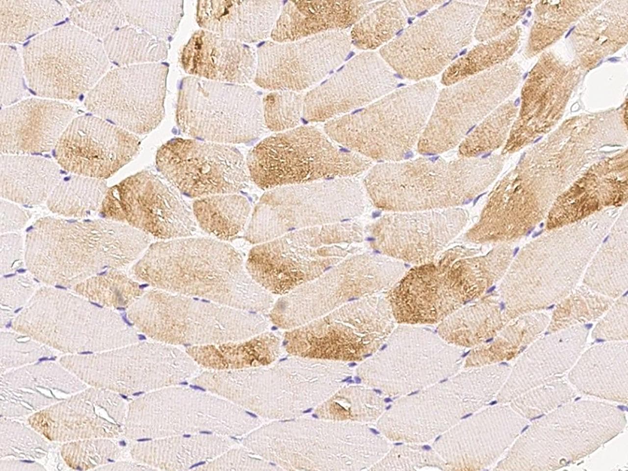 TPM2 Antibody (Preservative Free)
