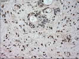NTRK3 / TRKC Antibody (clone OTI24B3)