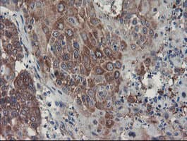 SENP2 Antibody (aa139-523, clone OTI1B8)