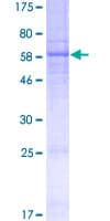 Human MOGAT1 / MGAT1 Protein (Recombinant GST)