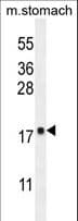 DYNLRB2 Antibody (aa49-77)
