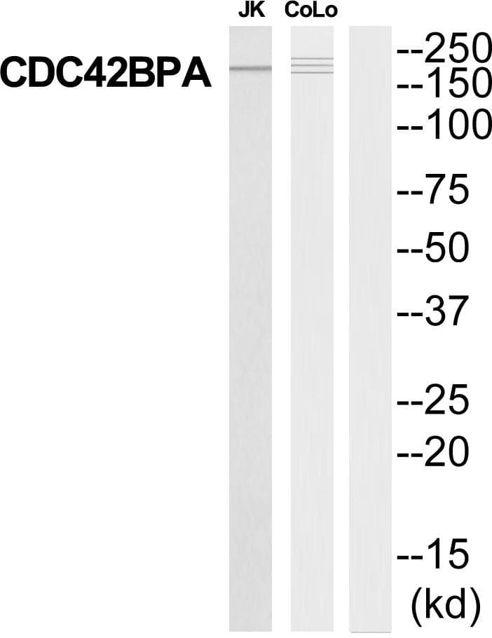 Polyclonal Rabbit anti-Human CDC42BPA / MRCK Antibody (WB)