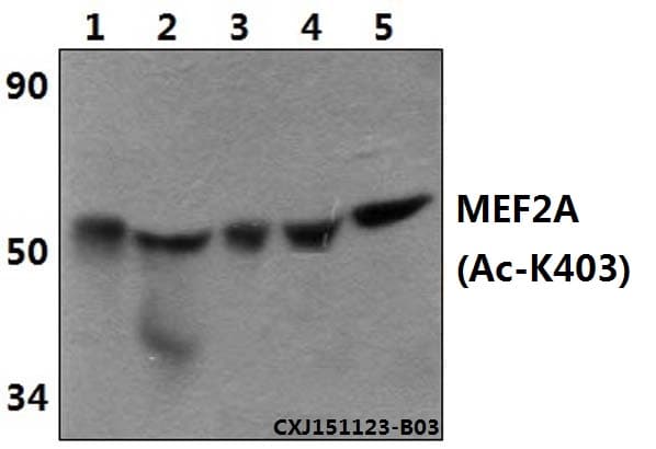 MEF2A / MEF2 Antibody (Acetyl-Lys403)