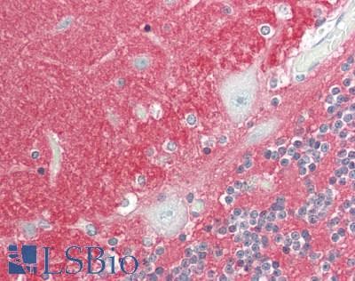 PathPlus™ NCAM / CD56 Antibody (aa20-718, clone 1G4)