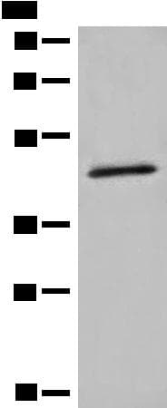 Polyclonal Rabbit anti-Human HMBS / PBGD Antibody (WB)