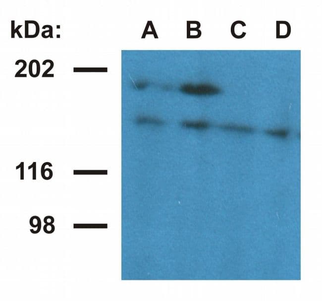 UBN1 / Ubinuclein 1 Antibody (clone UBN1-02)