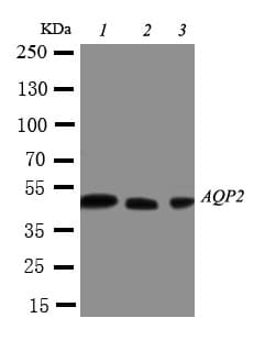 AQP2 / Aquaporin 2 Antibody (aa245-260)