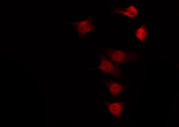 NOS3 / eNOS Antibody (phospho-Ser615)