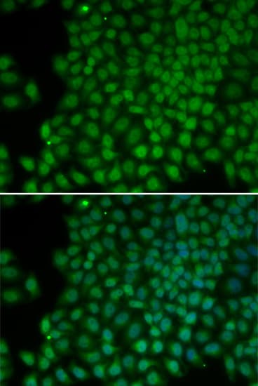 Polyclonal Rabbit anti-Human POLR1C / RPA39 Antibody (IHC, IF, WB)