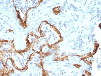KRT8 / CK8 / Cytokeratin 8 Antibody (clone SPM192)