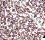 Recombinant Monoclonal Rabbit anti-Human CD3 Antibody (clone RBT-CD3, Ready-to-Use, IHC)