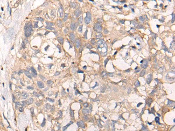 C5orf13 Antibody