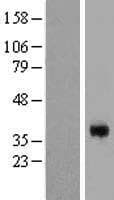 CGR19 / CGRRF1 Protein (Over-Expression Lysate Myc-DDK (Flag))