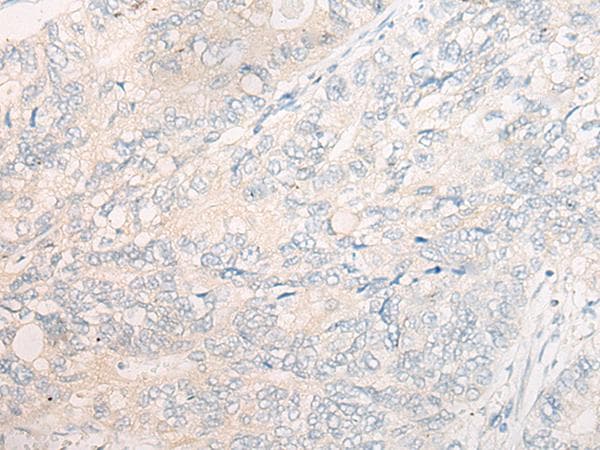 Polyclonal Rabbit anti-Human CYB5R3 / B5R Antibody (IHC)