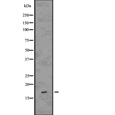 CAV3 / Caveolin 3 Antibody