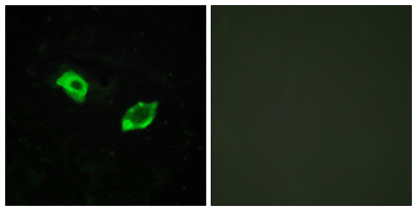 Polyclonal Rabbit anti-Human GPR158 Antibody (aa1-50, IHC, IF, WB)
