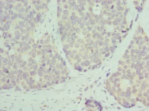 RPL9 / Ribosomal Protein L9 Antibody