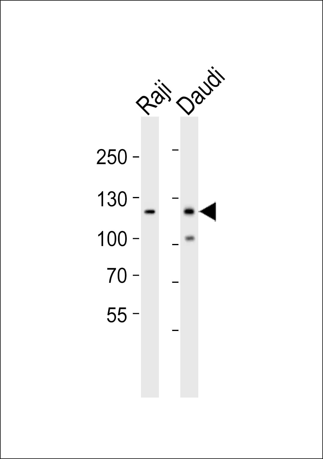 PTK2B / PYK2 Antibody (aa805-838)