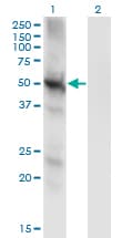 PPP3CC / CALNA3 Antibody (clone 4D1)