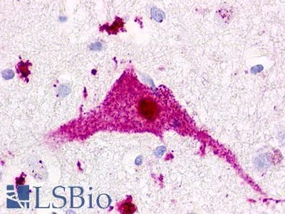 PathPlus™ Polyclonal Rabbit anti-Human P2RY1 / P2Y1 Antibody (Extracellular Domain, IHC)