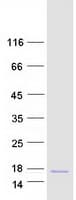 Human DEFA1 / Defensin Alpha 1 Protein (Recombinant Myc-DDK (Flag))